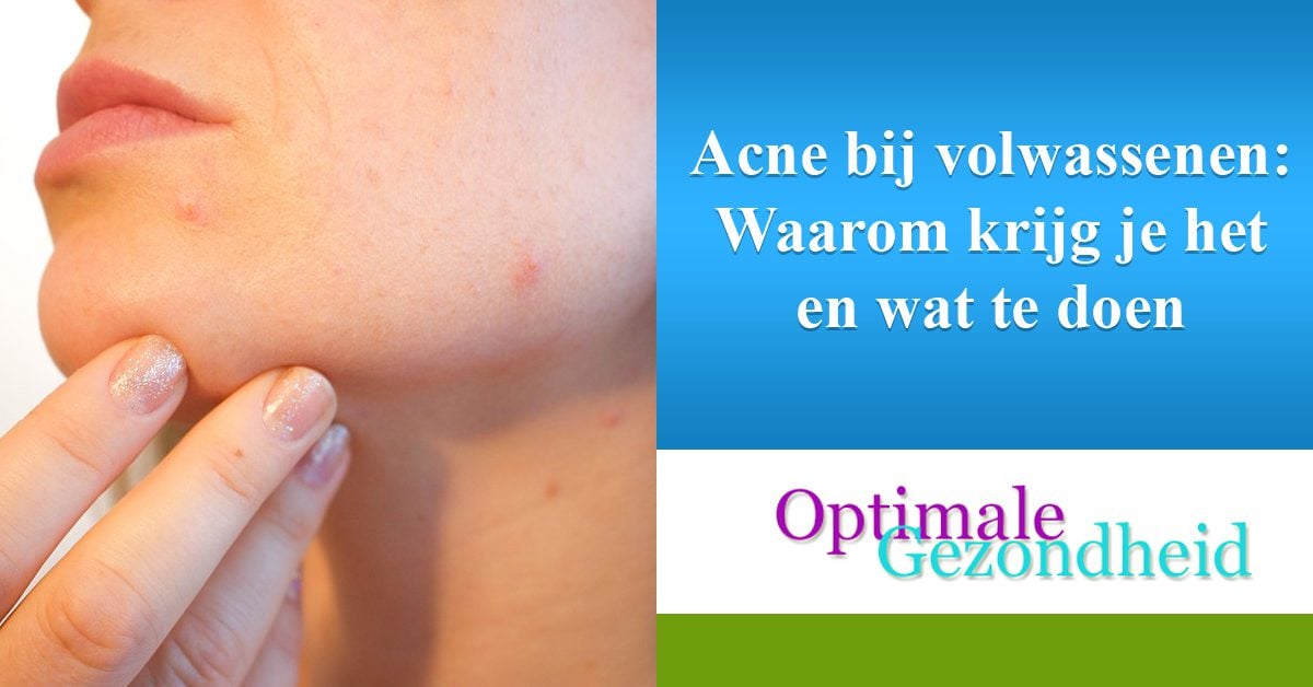 Acne bij volwassenen. Wat is de oorzaak en de oplossing? Acne bij volwassenen. Wat is de oorzaak en de oplossing?
