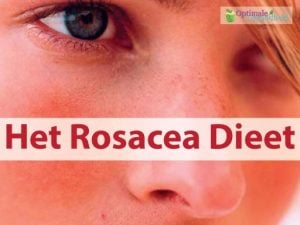 rosacea-dieet